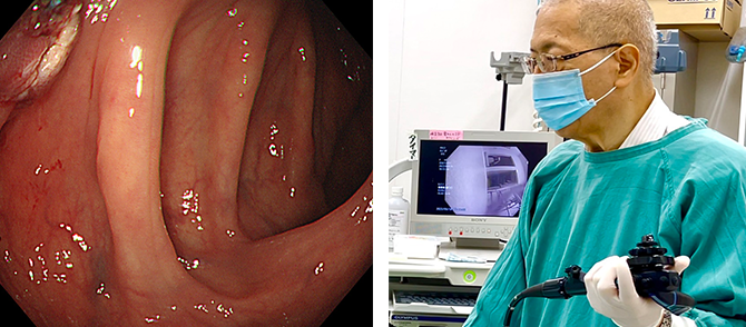 胃カメラについて